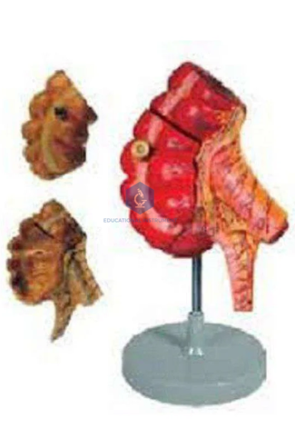 Appendix and Caecum